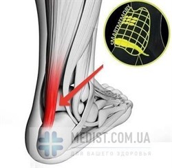 Компрессионные гольфы с анатомическими вставками ДЛЯ ПОДДЕРЖКИ АХИЛЛОВА СУХОЖИЛИЯ medi СЕР 1 класс компрессии с закрытым носком ДЛЯ ЖЕНЩИН И МУЖЧИН